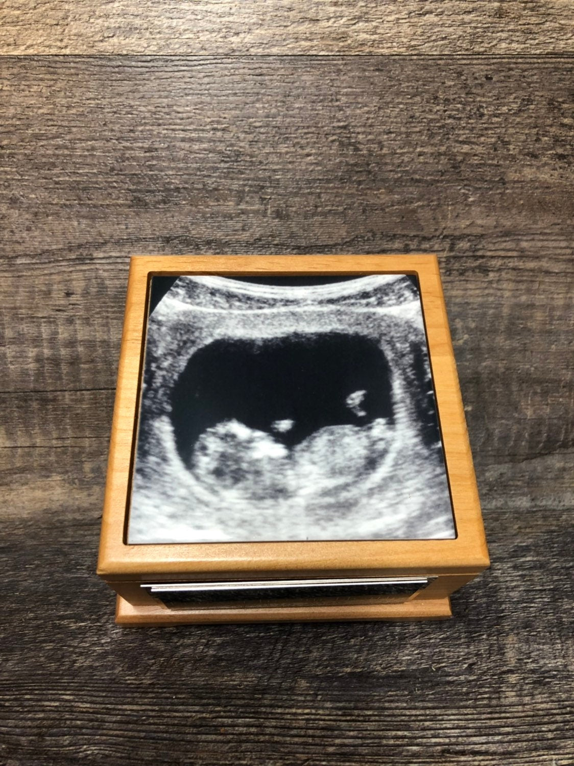 Custom Miscarriage Memorial Urn Ultrasound Photo Cremation Urn Baby Urn For Ashes Infant Urn Tile & Personalized Engraved Tag Memorial